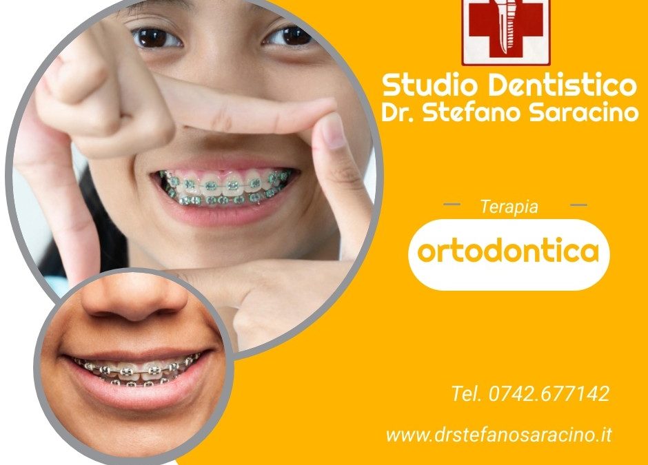 Terapia ortodontica
